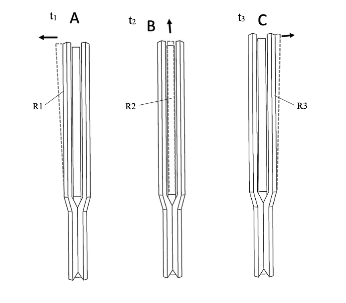 FIG-N1-21: Schematic representation of the preliminarily observed variability of arm motion in slow-motion video.